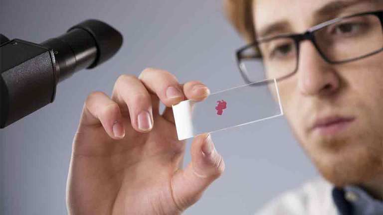 blood sample examined by lab technician