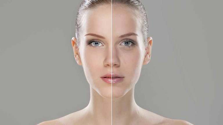 woman pre and post treatment