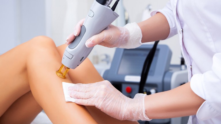 laser hair removal lead